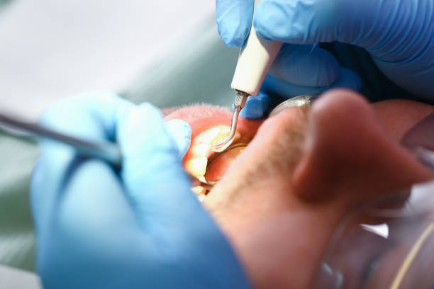 Best Urgent Care for Lost Fillings or Crowns in Locust, NC
