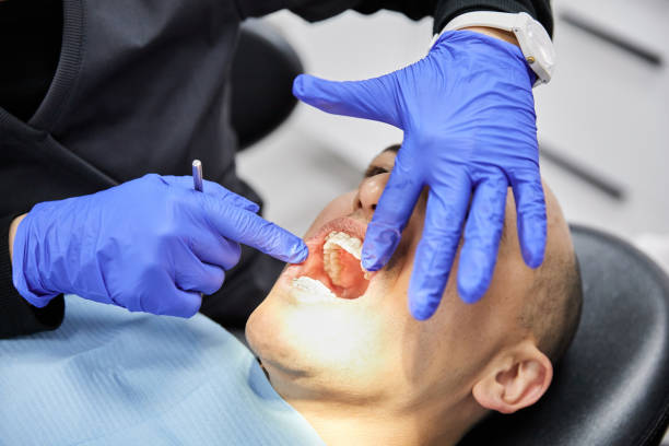 Best Emergency Wisdom Teeth Removal in Locust, NC